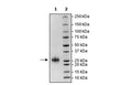 CLEC2D, His-Avi-Tag, Biotin-Labeled Recombinant – Figure 1 of 2