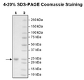 KRAS (G12D), Isoform A, His-Tag, GppNHp-Loaded Recombinant – Figure 1 of 2