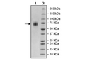 TPBG, Avi-His-Tag Recombinant – Figure 1 of 1