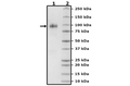 TPBG, Fc Fusion (lgG), Avi-Tag Recombinant – Figure 1 of 1