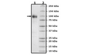 TPBG, Fc Fusion (lgG1), Avi-Tag, Biotin Labeled Recombinant – Figure 1 of 2