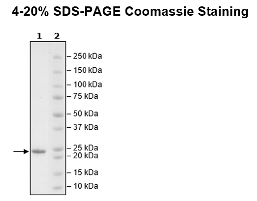 KRAS, Isoform B, His-Tag, GDP-loaded Recombinant – Figure 1 of 2