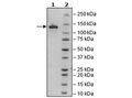 CD93, Fc Fusion (lgG1), Avi-Tag Recombinant – Figure 1 of 2