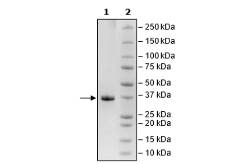 IGFBP7, Avi-His-Tag Recombinant – Figure 1 of 2