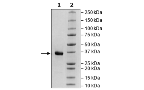 IGFBP7, Avi-His-Tag, Biotin-Labeled Recombinant – Figure 1 of 3