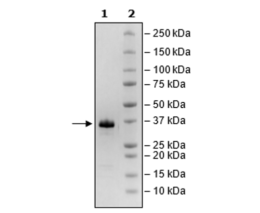 IGFBP7 (K95R), Avi-His-Tag Recombinant – Figure 1 of 1