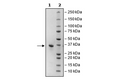 IGFBP7 (K95R), Avi-His-Tag, Biotin-Labeled Recombinant – Figure 1 of 2