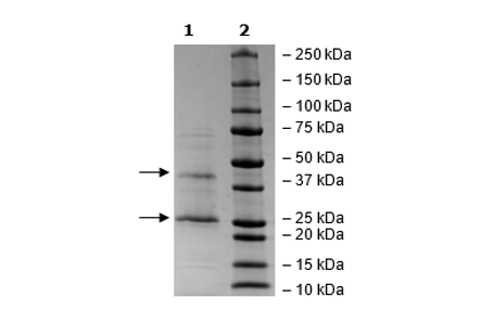 Claudin-18 Isoform 2, FLAG-Tag Recombinant – Figure 1 of 3