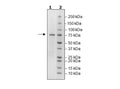 p53 (Y220C), GST-Tag Recombinant – Figure 1 of 1