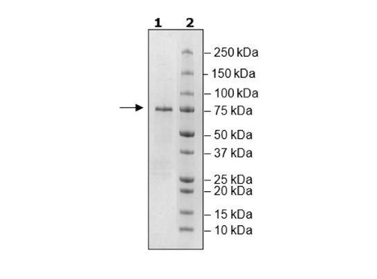 p53 (Y220C), GST-Tag Recombinant – Figure 1 of 1
