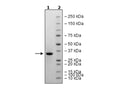 3CL Protease (T21I, A173V) (SARS-CoV-2) Recombinant – Figure 1 of 1
