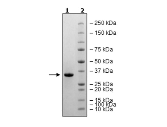 3CL Protease (T21I, A173V) (SARS-CoV-2) Recombinant – Figure 1 of 1