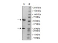 Anti-PSMA Antibody – Figure 1 of 1