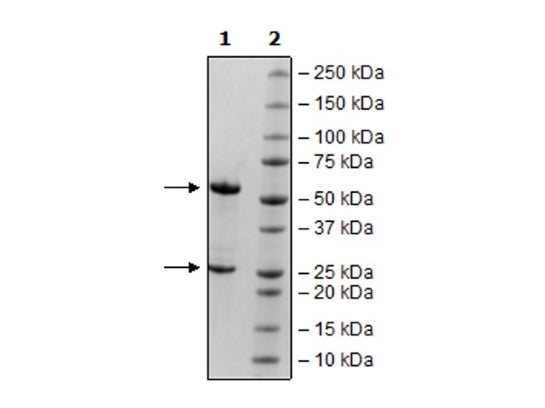 Anti-PSMA Antibody – Figure 1 of 1