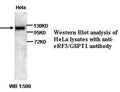 Anti-GSPT1 Antibody – Figure 1 of 1