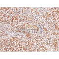 Phospho-Acinus (Ser1180) Antibody – Figure 1 of 4