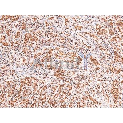 Phospho-Acinus (Ser1180) Antibody – Figure 1 of 4