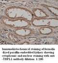 Anti-TBPL1 Antibody – Figure 1 of 1