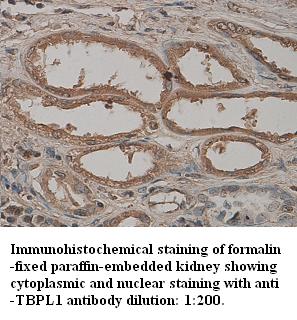 Anti-TBPL1 Antibody – Figure 1 of 1