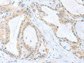 PDE6D Polyclonal Antibody – Figure 1 of 2