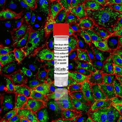Human Brain Microvascular Endothelial Cells (HBMVEC)