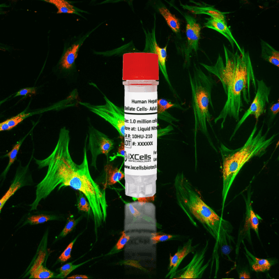 Human Hepatic Stellate Cells- Adult (HHSC)