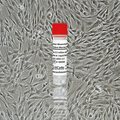 Human Mesenchymal Stem Cells-Bone Marrow (HMSC-bm)