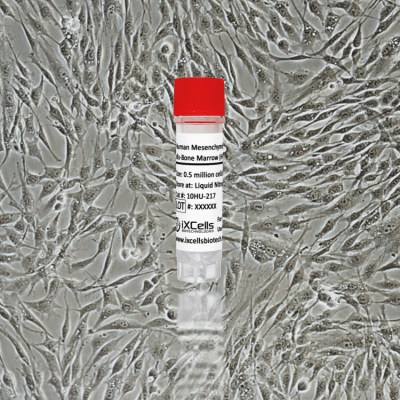 Human Mesenchymal Stem Cells-Bone Marrow (HMSC-bm)