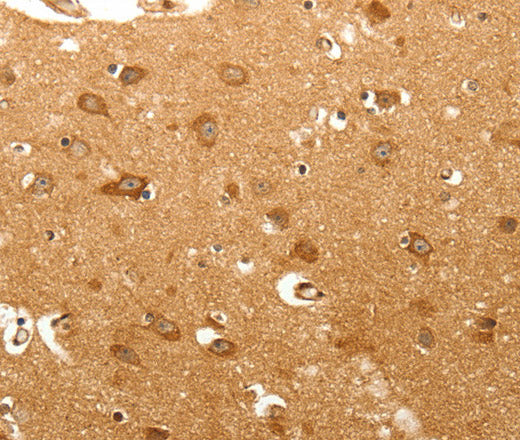 MAP1B Polyclonal Antibody – Figure 1 of 3