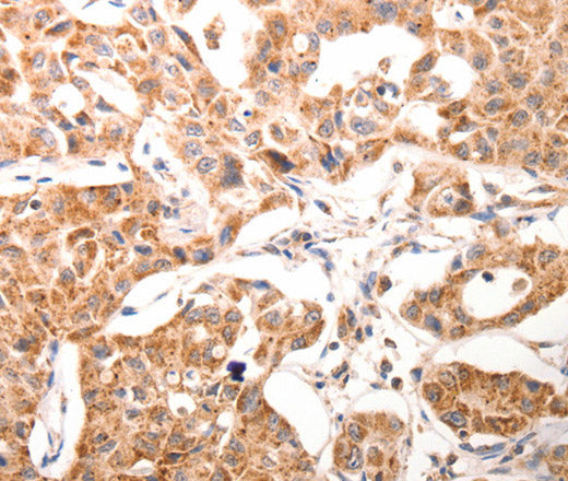 BGLAP Polyclonal Antibody – Figure 1 of 3