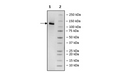 Anti-DLL3-Anti-CD3 Bispecific Molecule – Figure 1 of 2