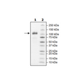 ACE2, His-Tag Recombinant – Figure 1 of 4