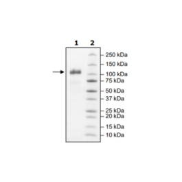 ACE2, His-Tag Recombinant – Figure 1 of 4