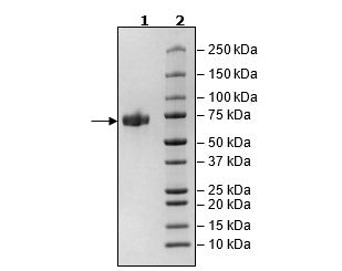 ACHE, His-Tag Recombinant – Figure 1 of 1