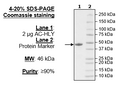 AC-HLY, His-FLAG-Tags Recombinant – Figure 1 of 1