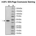 Cathepsin E, His-Tag Recombinant – Figure 1 of 1