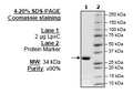 LpxC (E. coli) Recombinant – Figure 1 of 1