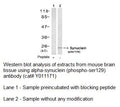 Anti-β-Synuclein (Phospho-Ser129) Antibody – Figure 1 of 1
