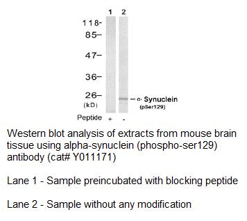 Anti-β-Synuclein (Phospho-Ser129) Antibody – Figure 1 of 1