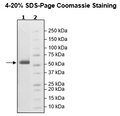 MMP13, His-Tag Recombinant – Figure 1 of 1