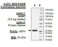 NNMT, His-Tag Recombinant – Figure 1 of 2