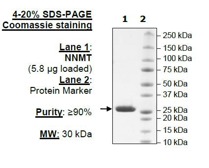 NNMT, His-Tag Recombinant – Figure 1 of 2