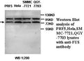 Anti-Fus Antibody – Figure 1 of 1