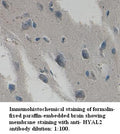 Anti-HYAL2 Antibody – Figure 1 of 1