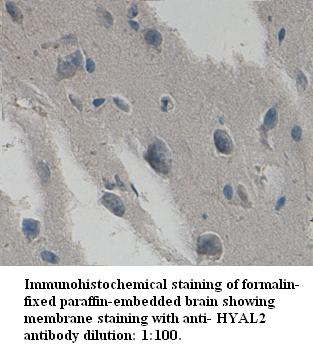 Anti-HYAL2 Antibody – Figure 1 of 1