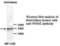 Anti-NPHS2 Antibody – Figure 1 of 1