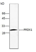 Anti-PRDX1 Antibody – Figure 1 of 1