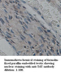 Anti-TdT Antibody – Figure 1 of 1