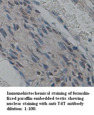Anti-TdT Antibody – Figure 1 of 1