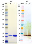 Recombinant TSST-1 (tag free) - Figure 1 of 1